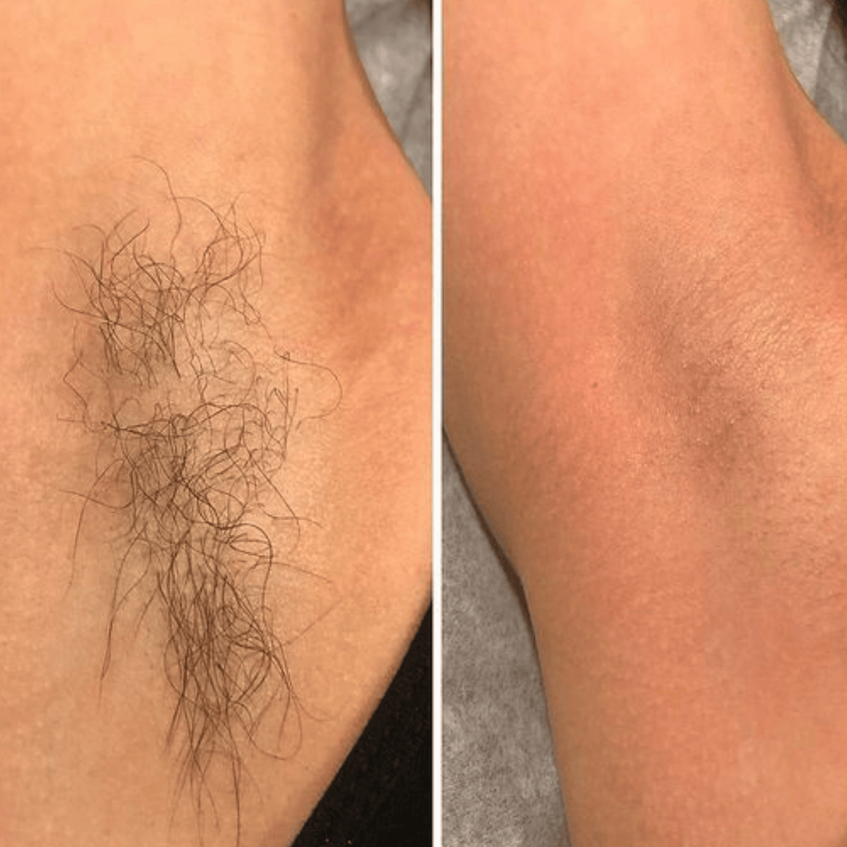 Crema depilatoria natural DETVFO: depilación ultrasuave y sin dolor, para él y para ella.