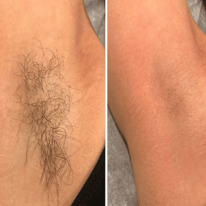 Crema depilatoria natural DETVFO: depilación ultrasuave y sin dolor, para él y para ella.