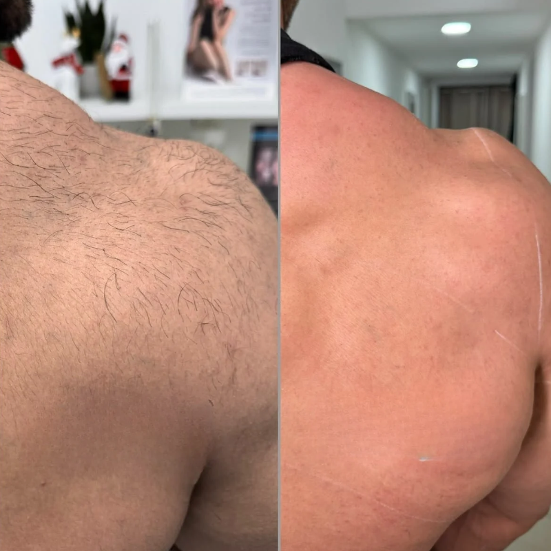 Crema depilatoria natural DETVFO: depilación ultrasuave y sin dolor, para él y para ella.